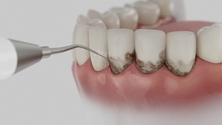 Reliable Dental Implants contractor in Clarksville, VA by Smile Center Dentistry